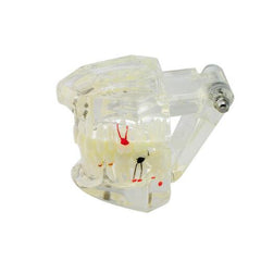 Dental Implant Teaching Model with Restoration & Bridge